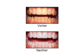 Traumhafte Ergebnisse für die schönsten Zähne.